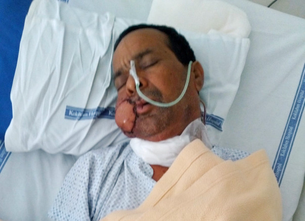 PLEASE HELP MY FATHER TO FIGHT WITH CANCER