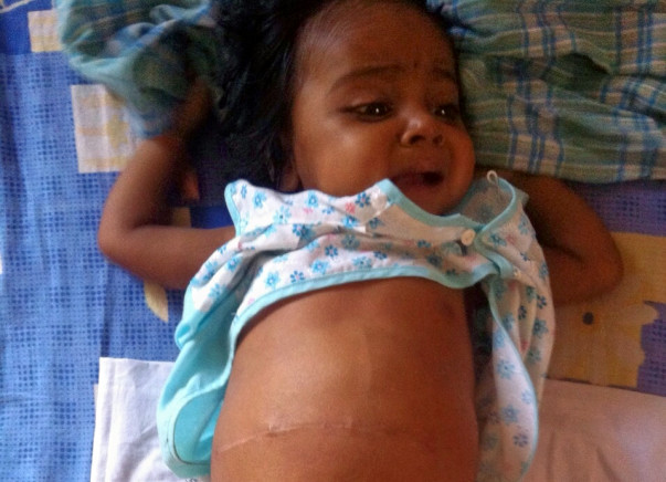 I am fundraising to buy book "Misha learns about money on Amazon to fund Baby Jhiya's treatment