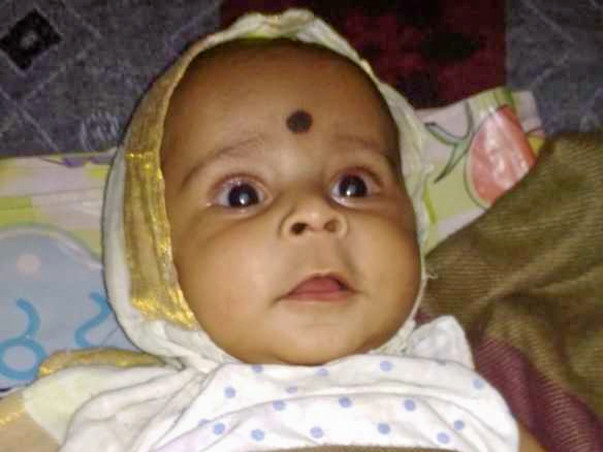 Help 5-month-old Baby Undergo Cataract Surgery A Heart Surgery