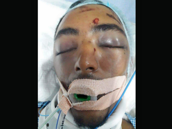 Help Mohamed Zabi Recover From An Accident
