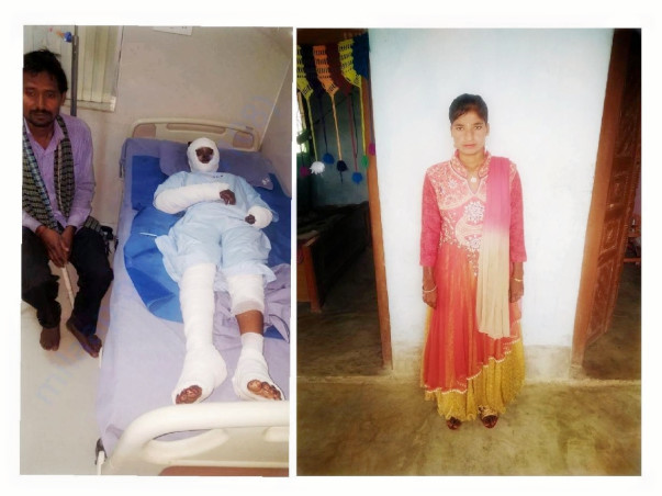 Help Burn Survivor Pratima Get Married