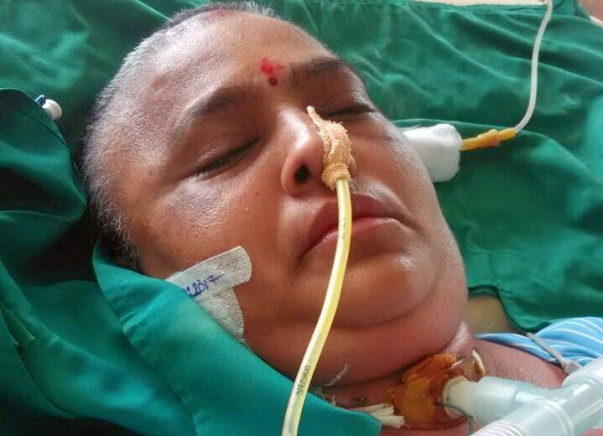 Help Bhavna fight Brain hemorrhage