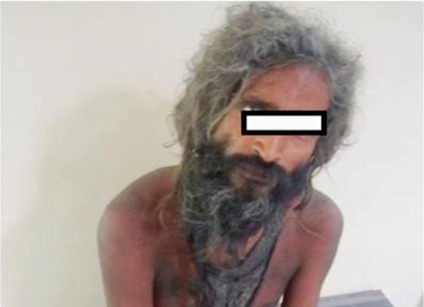 I am fundraising to rehabilitation of Mentally ill destitute