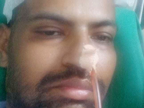 Help My Brother Nusrat Undergo Brain surgery