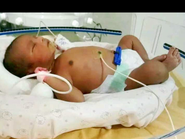 Support Baby Madhu Recover From Intestinal Problems