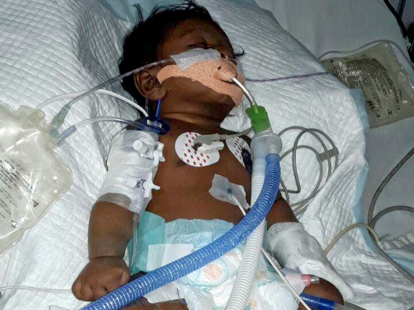 50 day Old kid with pneumonia needs money for treatment