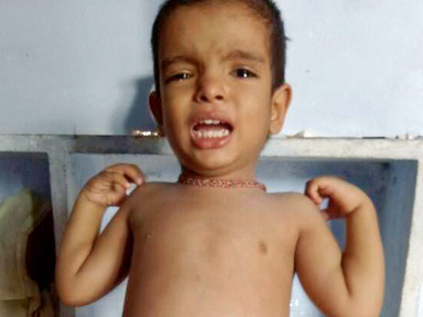 When We See Our Son Unable To Eat Basic Liquid Food,We Stop Eating Too