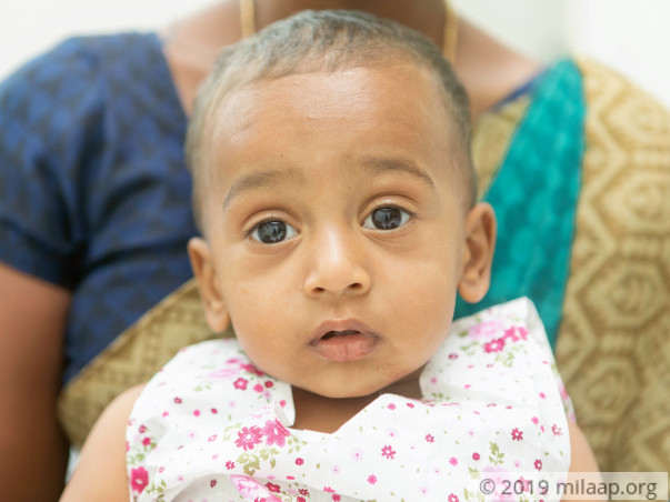 A Deadly Bone Infection Will Cripple And Kill This 1-year-old Baby