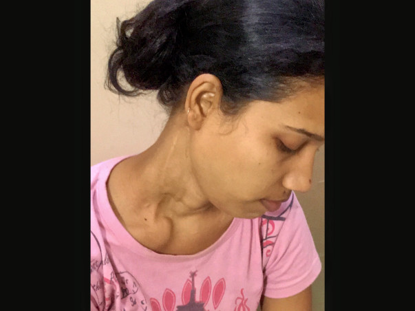 Help Rajni Recover from Carcinoma Thyroid