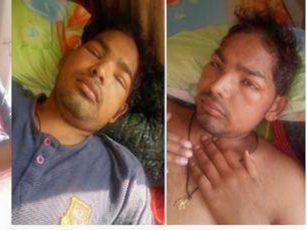 please help for my brother for kidney transplant