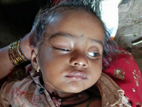 Help Baby Kiran Fight Against Blindness