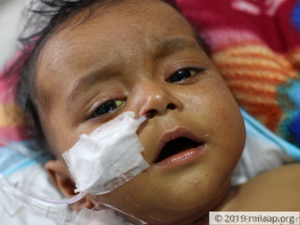 5-Month-Old With Liver Disease Has Few Days Left To Get Transplant
