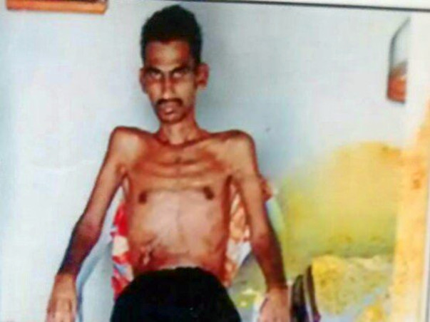 Help Mr Narasimha to fight back. He met with tragic accident lost limb
