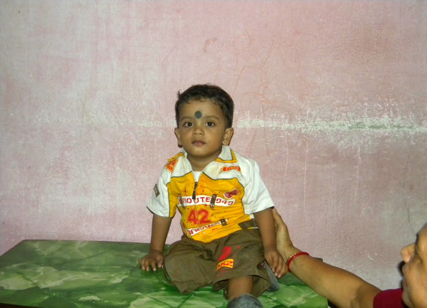 Help Baby Debrup Undergo Bone Marrow Transplant