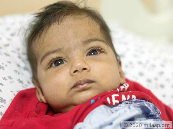 This 6-month-old baby boy is fighting a severe liver disease