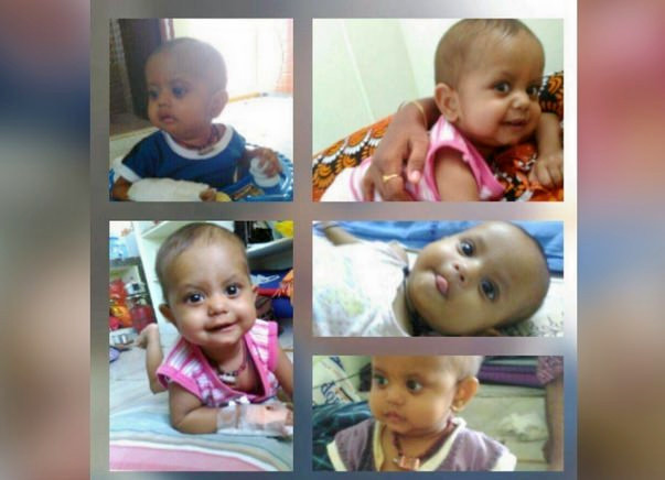 Help My 22-Month-Old Son Undergo A Bone Marrow Transplant