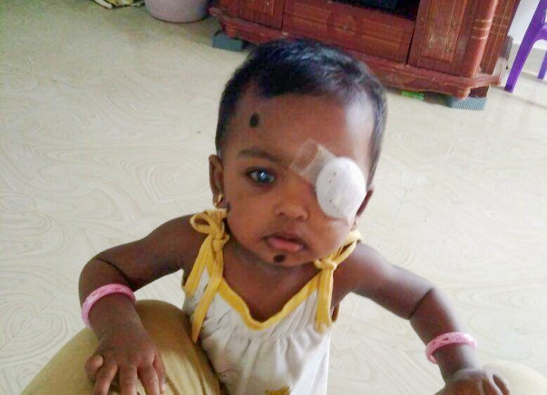 Give Baby Tanmayi the gift of Vision and Sight