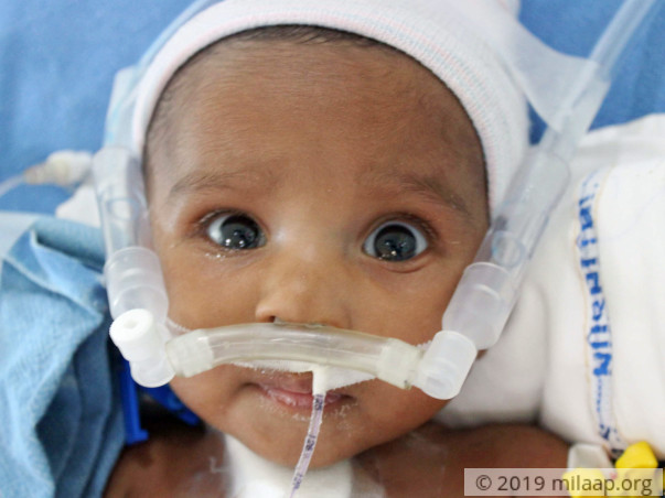 Baby of Srinivas Reneeds your help to survive