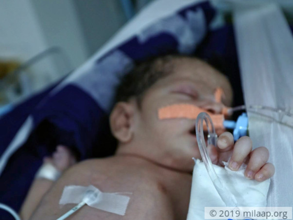 Help Ruksar's Baby Recover From Pulmonary Hemorrhage