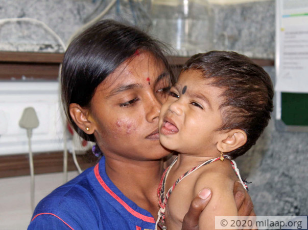 His First Steps Revealed His Deformed Spine, Needs Urgent Surgery