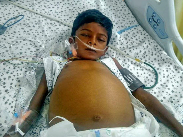 8-year-old Pawan Needs A Liver Transplant In Five Days To Live