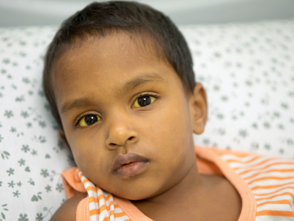 Weaver Begs Village To Save His 3-year-old Son From Liver Failure