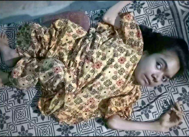 Help Roma Fight Rickets