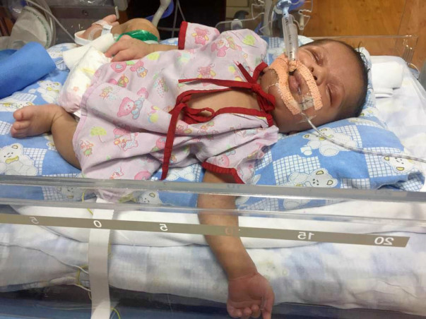 Help 25-days-old Baby Krishna Get Open Heart Surgery