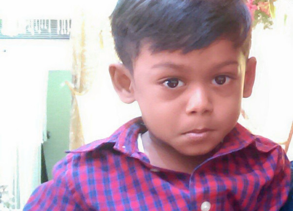 Help JERRY MANOAH fight Lipomeningo myelocoele