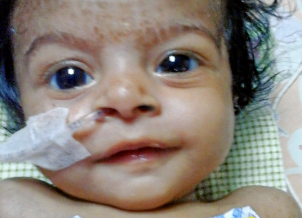 Seeking Support To Save My 3-Month-Old Daughter