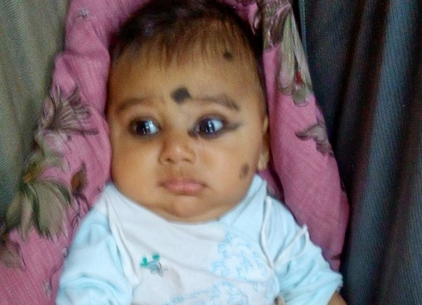 This 4-month-old Baby Is Fighting Cancer Of Nerve Cells To Stay Alive