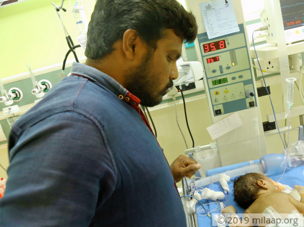 Unemployed For Almost A Month Now, Father Needs Help To Save His Baby