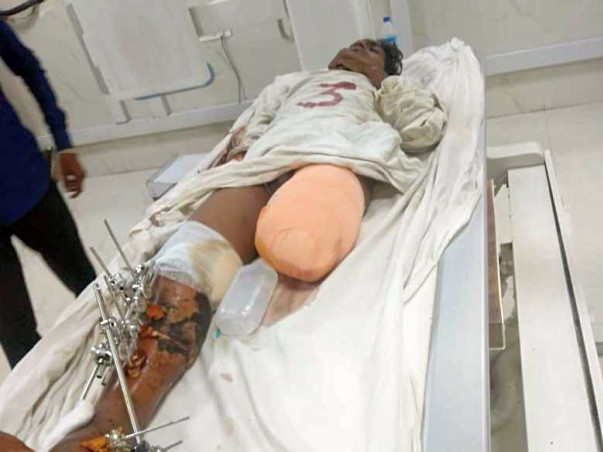 Help Sachin Who Met With A Severe Road Accident.