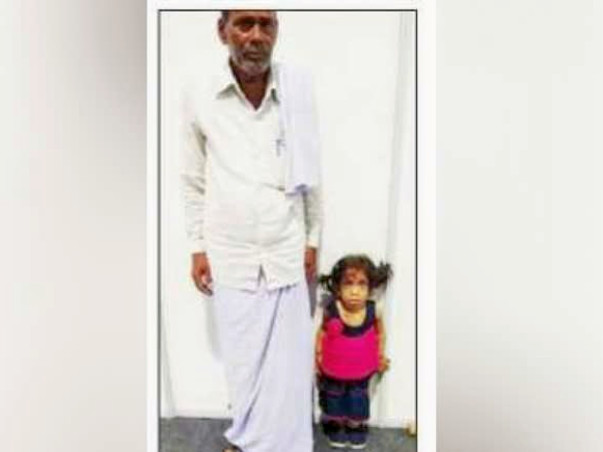 Help 7-Year-Old Tanmayi Lead A Normal Life