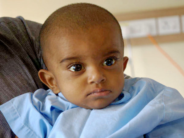 This 8-month-old needs a liver transplant to survive