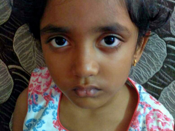 At 5, She Has No Idea What Cancer Is; But She Is Fighting It Bravely.