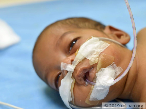 Help Baby of Priyanka Survive
