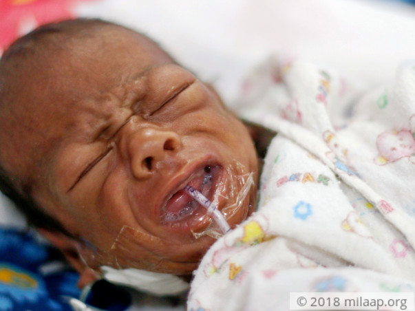 This 2-month-old baby boy will not survive without urgent help