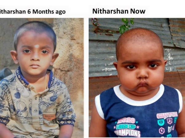Help Nitharshan Undergo Stem Cell Transplant