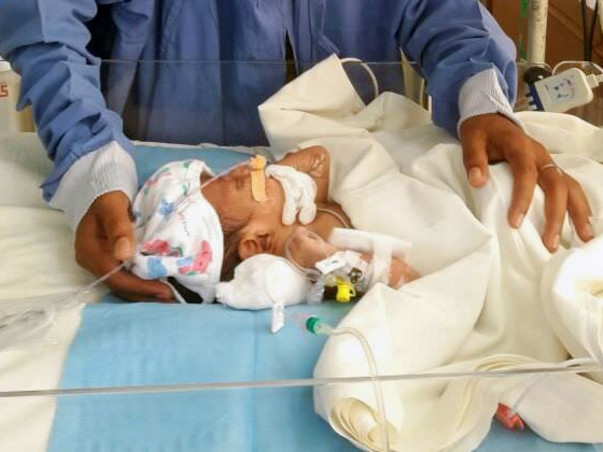 Help Bhagya's baby fight a severe stomach disease