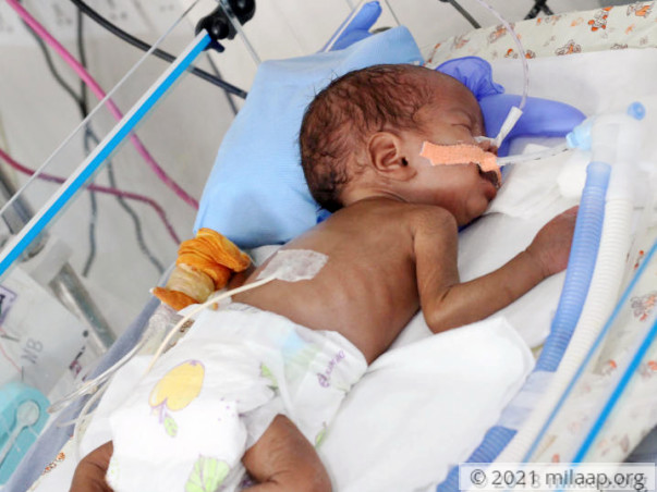 After Losing One Baby, This Couple Now Struggles to Save The Other