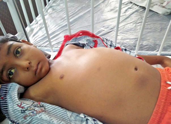 Help Little boy Nandhan Undergo A Liver Transplante