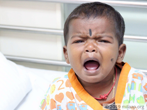 1-Year-Old Baby Girl Battling A Deadly Heart Disease Needs Urgent Help