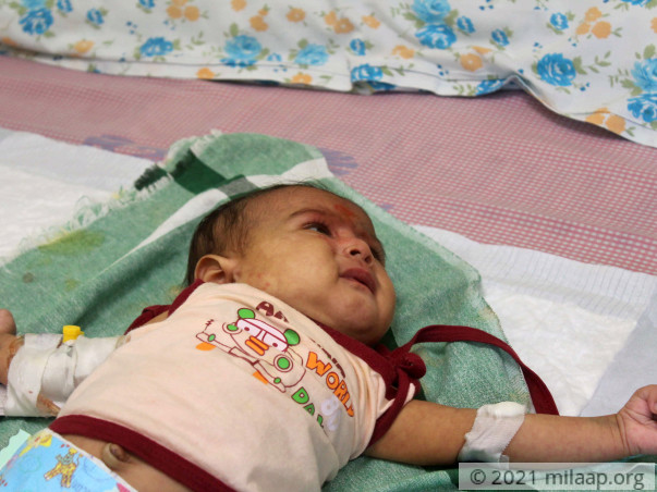 Every Passing Minute Is Crucial To 1-Month-Old Baby Without Treatment