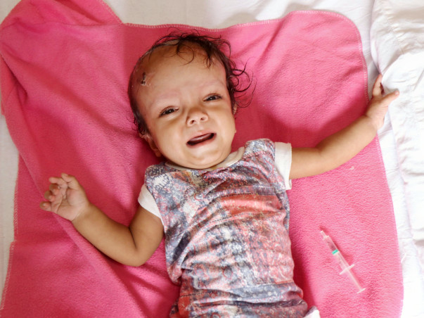 Daily Wager Struggles To Save 9-Month-Old From Brain Tumor