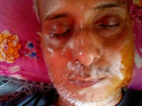 Save a life help Anil to survive