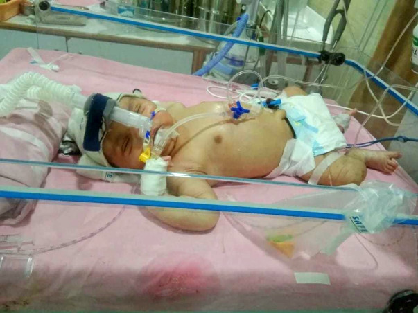 9 days old baby requires your help to survive.