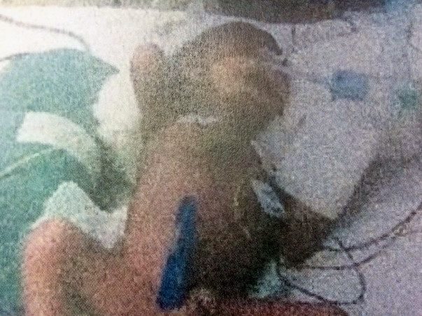 Help 3 Small Premature Babies fighting for a life in NICU