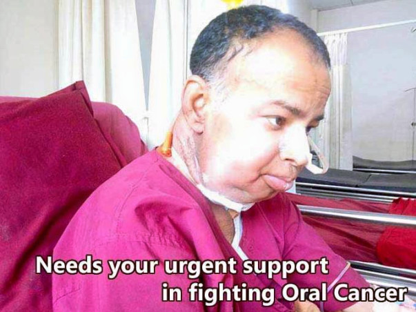 This 40 years old needs your urgent support in fighting Oral Cancer