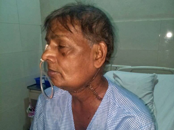 Help Shrinath Chauhan Fighting Tongue Cancer